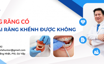 NIỀNG RĂNG CÓ GIỮ LẠI ĐƯỢC RĂNG KHỂNH KHÔNG?