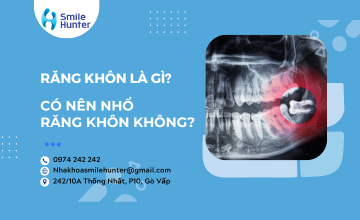 RĂNG KHÔN LÀ GÌ? CÓ NÊN NHỔ RĂNG KHÔN KHÔNG?