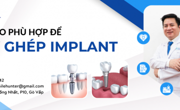 KHI NÀO NÊN CẤY GHÉP RĂNG IMPLANT