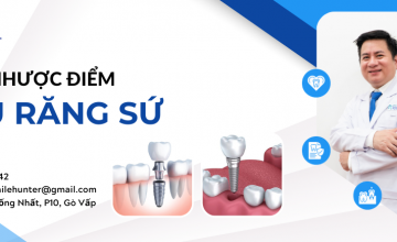 TRỒNG RĂNG SỨ BẮC CẦU CÓ TỐT KHÔNG? ƯU & NHƯỢC ĐIỂM