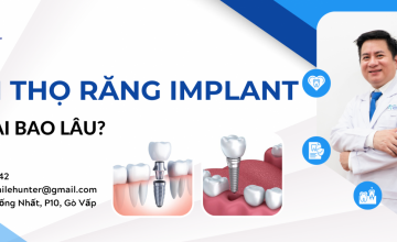 TUỔI THỌ RĂNG IMPLANT KÉO DÀI ĐƯỢC BAO LÂU?