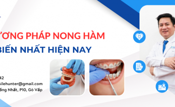 CÁC LƯU Ý KHI ỨNG DỤNG NONG HÀM TRONG CHỈNH NHA