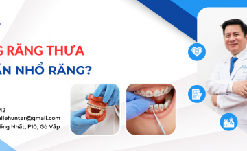 NIỀNG RĂNG THƯA CÓ PHẢI NHỔ KHÔNG?