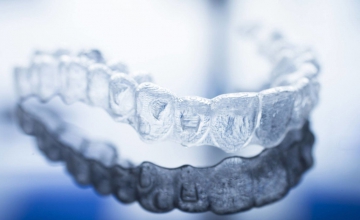 Niềng răng trong suốt invisalign và những điều cần biết