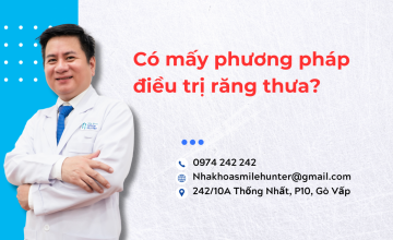 Có mấy phương pháp điều trị răng thưa ?