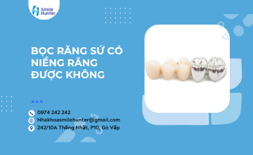 BỌC RĂNG SỨ CÓ NIỀNG RĂNG ĐƯỢC KHÔNG