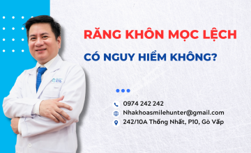 RĂNG KHÔN MỌC LỆCH CÓ NGUY HIỂM KHÔNG?