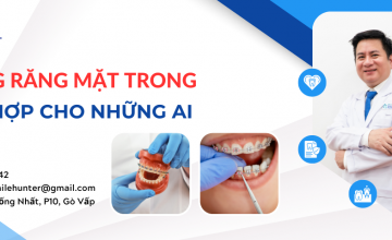 NIỀNG RĂNG MẶT TRONG PHÙ HỢP CHO NHỮNG AI