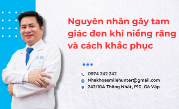 Nguyên nhân gây tam giác đen khi niềng răng và cách khắc phục