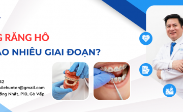 NIỀNG RĂNG HÔ CÓ BAO NHIÊU GIAI ĐOẠN