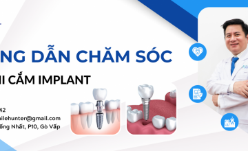 HƯỚNG DẪN CHĂM SÓC RĂNG MIỆNG SAU KHI CẮM IMPLANT