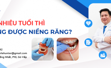 BAO NHIÊU TUỔI THÌ KHÔNG NIỀNG RĂNG ĐƯỢC?