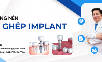 AI KHÔNG NÊN CẤY GHÉP RĂNG IMPLANT