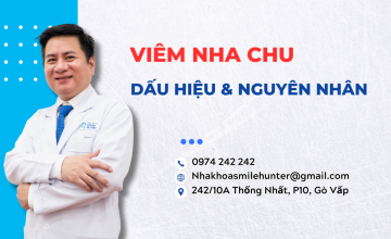 VIÊM NHA CHU: DẤU HIỆU - NGUYÊN NHÂN