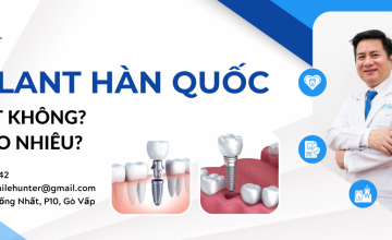 TRỒNG RĂNG IMPLANT HÀN QUỐC CÓ TỐT KHÔNG ? GIÁ BAO NHIÊU ?