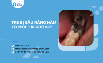 TRẺ BỊ SÂU RĂNG HÀM CÓ MỌC LẠI KHÔNG?