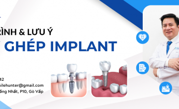 QUY TRÌNH CẤY GHÉP IMPLANT VÀ NHỮNG LƯU Ý