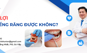 VIÊM LỢI CÓ NIỀNG RĂNG ĐƯỢC KHÔNG?