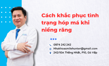 Cách khắc phục tình trạng hóp má khi niềng răng