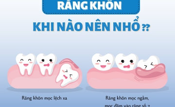 KHI NÀO NÊN NHỔ RĂNG KHÔN? - NHA KHOA SMILE HUNTER