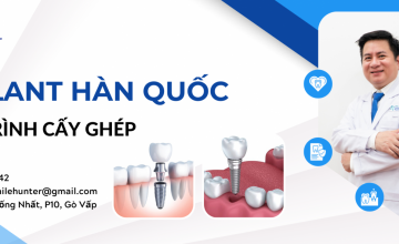 QUY TRÌNH CẤY GHÉP IMPLANT HÀN QUỐC