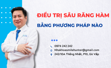 ĐIỀU TRỊ RĂNG HÀM BỊ SÂU BẰNG CÁCH NÀO?