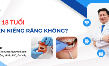 DƯỚI 18 TUỔI CÓ NÊN NIỀNG RĂNG KHÔNG?