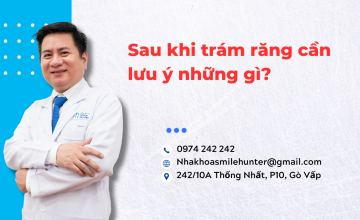 Sau khi trám răng cần lưu ý những gì?