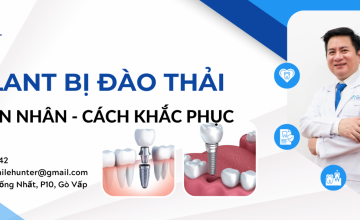 IMPLANT BỊ ĐÀO THẢI: NGUYÊN NHÂN & CÁCH KHẮC PHỤC