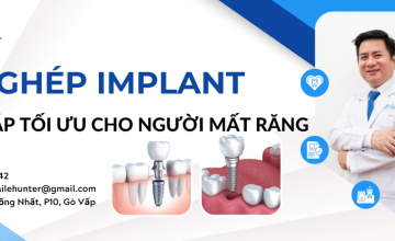 CẤY GHÉP IMPLANT - GIẢI PHÁP TỐI ƯU CHO NGƯỜI MẤT RĂNG