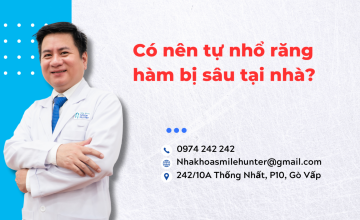 Có nên tự nhổ răng hàm bị sâu tại nhà?