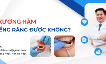 TIÊU XƯƠNG HÀM CÓ NIỀNG RĂNG ĐƯỢC KHÔNG