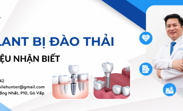 DẤU HIỆU CHỨNG TỎ TRỤ IMPLANT BỊ ĐÀO THẢI