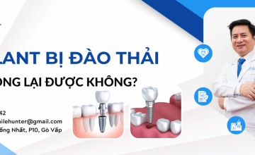 RĂNG IMPLANT BỊ ĐÀO THẢI CÓ TRỒNG LẠI ĐƯỢC KHÔNG?