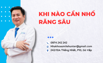 KHI NÀO CẦN NHỔ RĂNG SÂU