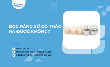 BỌC RĂNG SỨ CÓ THÁO RA ĐƯỢC KHÔNG?