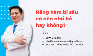 Răng hàm bị sâu có nên nhổ bỏ hay không?