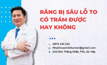 RĂNG BỊ SÂU LỖ TO CÓ TRÁM ĐƯỢC HAY KHÔNG