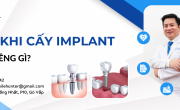 CẦN KIÊNG GÌ SAU KHI CẤY IMPLANT ĐỂ KHÔNG BỊ ĐÀO THẢI