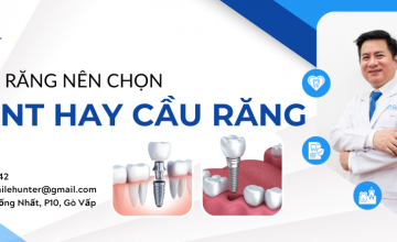 MẤT NHIỀU RĂNG NÊN CHỌN IMPLANT HAY CẦU RĂNG?