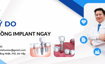 5 LÝ DO BẠN PHẢI TRỒNG RĂNG IMPLANT NGAY