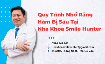 Quy Trình Nhổ Răng Hàm Bị Sâu Tại Nha Khoa Smile Hunter