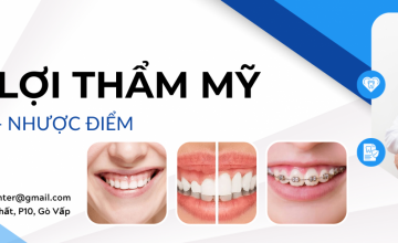 CẮT LỢI THẨM MỸ - ƯU VÀ NHƯỢC ĐIỂM