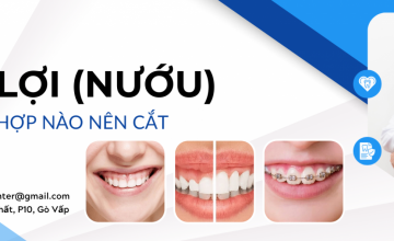 CÁC TRƯỜNG HỢP NÊN CẮT NƯỚU (LỢI)