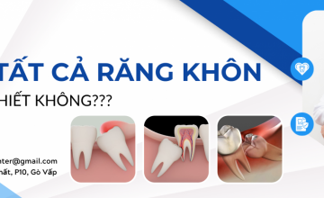 CÓ CẦN THIẾT PHẢI NHỔ TẤT CẢ RĂNG KHÔN KHÔNG?