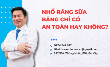 NHỔ RĂNG SỮA BẰNG CHỈ CÓ AN TOÀN HAY KHÔNG?