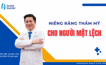 PHƯƠNG PHÁP NIỀNG RĂNG CHO NGƯỜI BỊ LỆCH MẶT