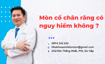 Mòn cổ chân răng có nguy hiểm không ?