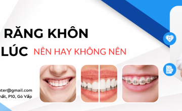 NHỔ 2 RĂNG KHÔNG CÙNG LÚC - NÊN HAY KHÔNG NÊN