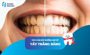 NHỮNG CÂU HỎI THƯỜNG GẶP VỀ TẨY TRẮNG RĂNG